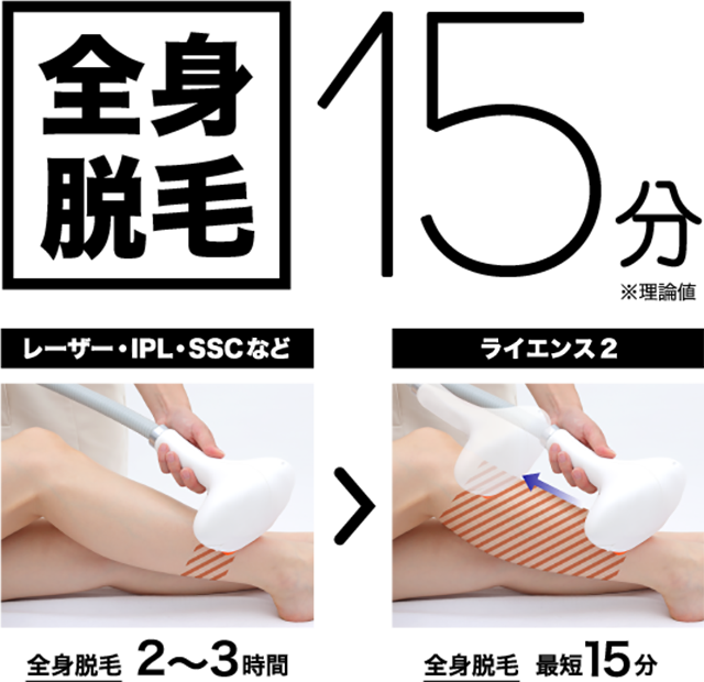 脱毛